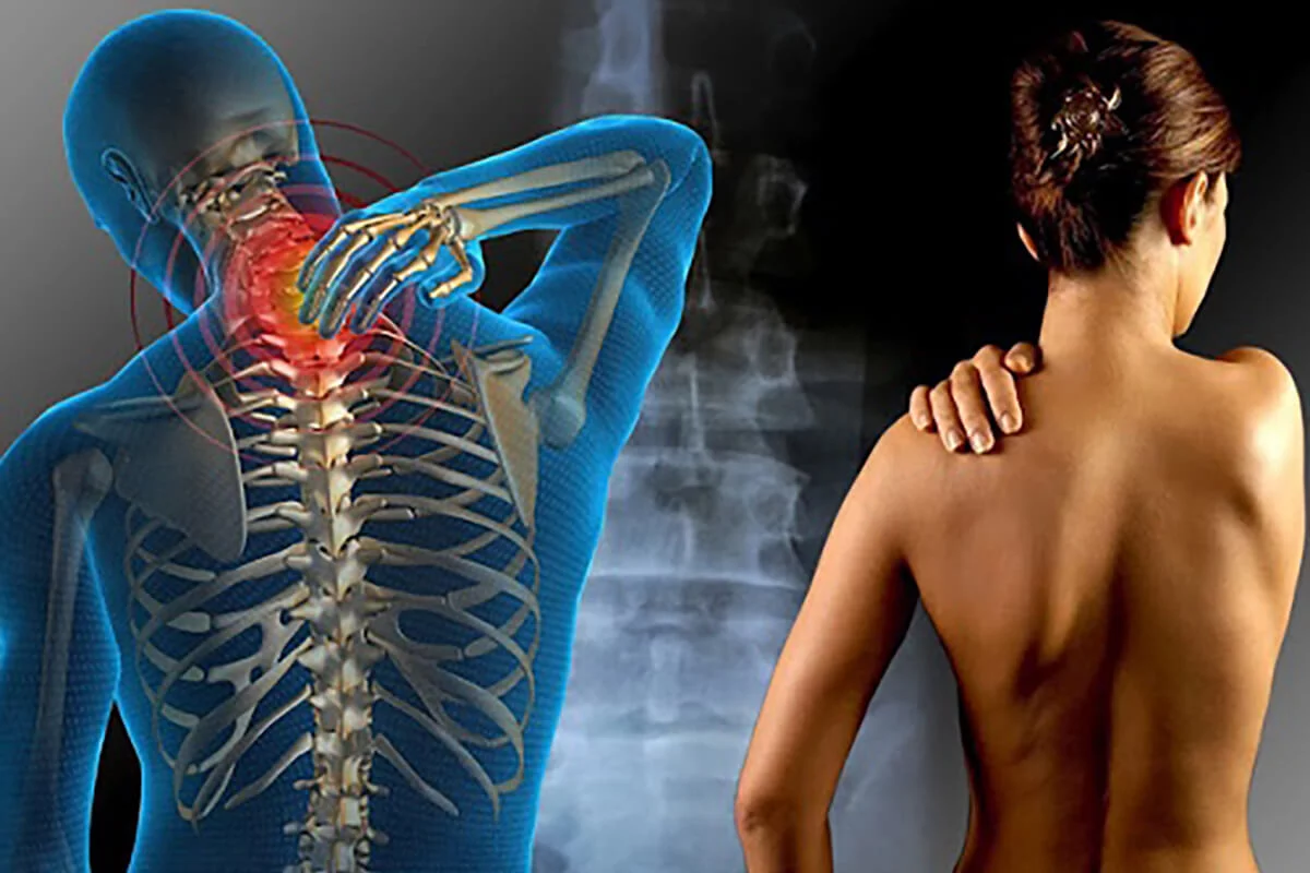 FIBROMYALGIE DOULEURS